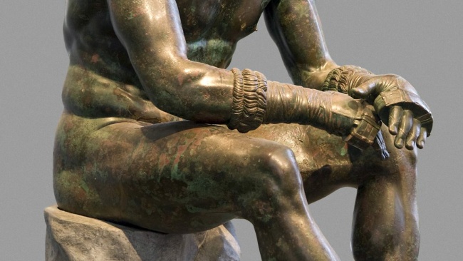 Seated Boxer, "The Terme Boxer" 300-200 B.C. (detail)