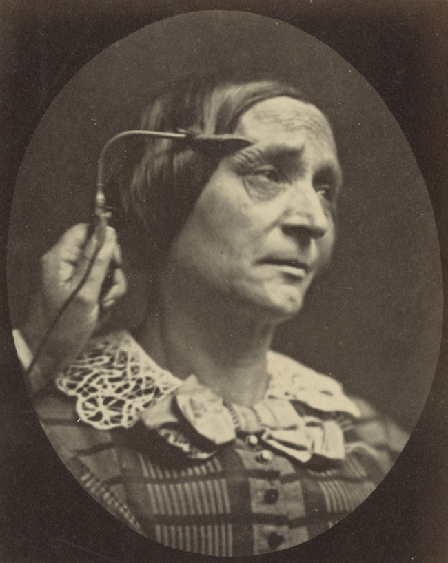 Guillaume-Benjamin Duchenne (French, 1806-1875) 'Figure 27, The Muscle of Pain' Negative 1854-1856; print 1876 (detail)