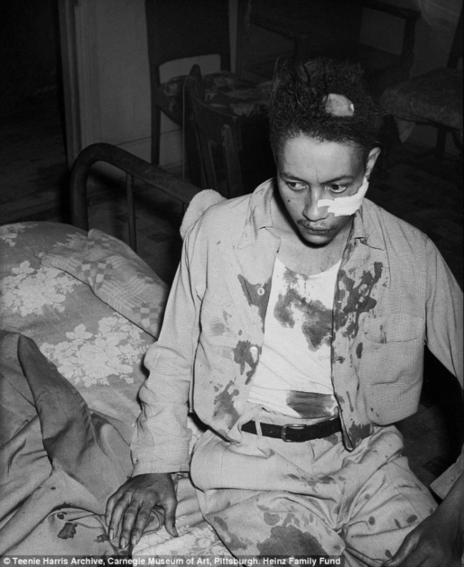 Charles "Teenie" Harris (1908-1998) 'John Davis after being beaten by police officer Dan McTague, in his home at 1303 Wylie Avenue, Hill District, August 1951' 1951
