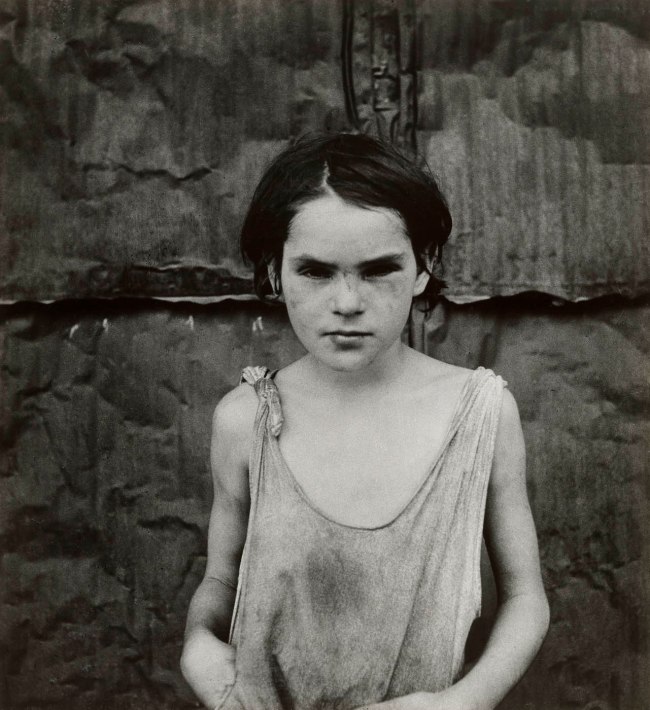 Dorothea Lange (American, 1895-1965) 'Child Living in Oklahoma City Shacktown [Damaged Child, Shacktown]' August 1936